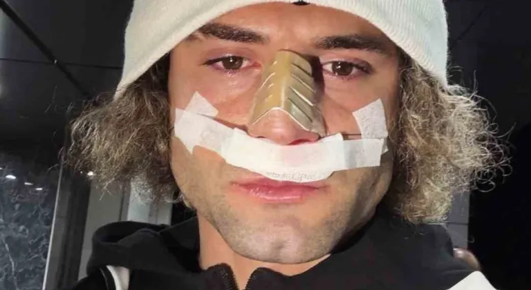 Elazığspor’da Fuat Bavuk’un burnu kırıldı