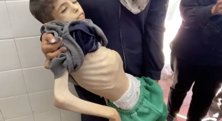 Gazze’de bir çocuk daha açlıktan hayatını kaybetti