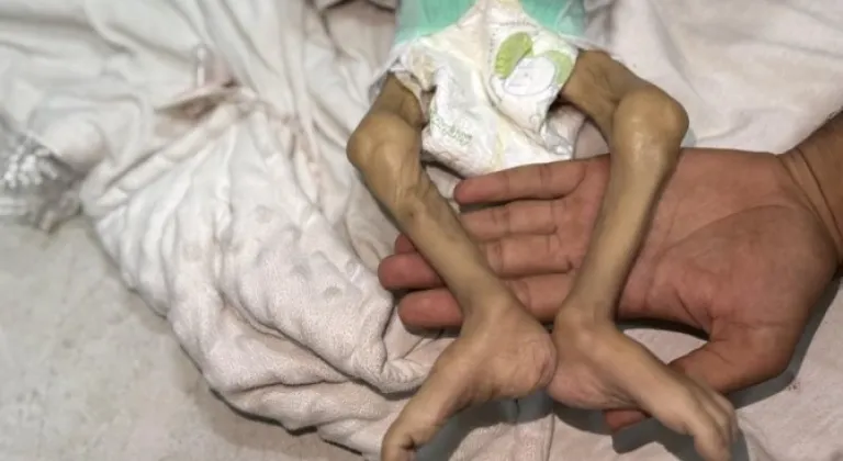 Gazze’de son 24 saatte 3 sivil açlıktan öldü