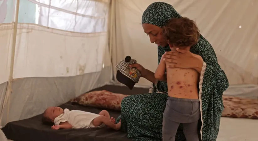 Gazze’de suçiçeği alarmı: Vakalar iki haftada 9 bini aştı